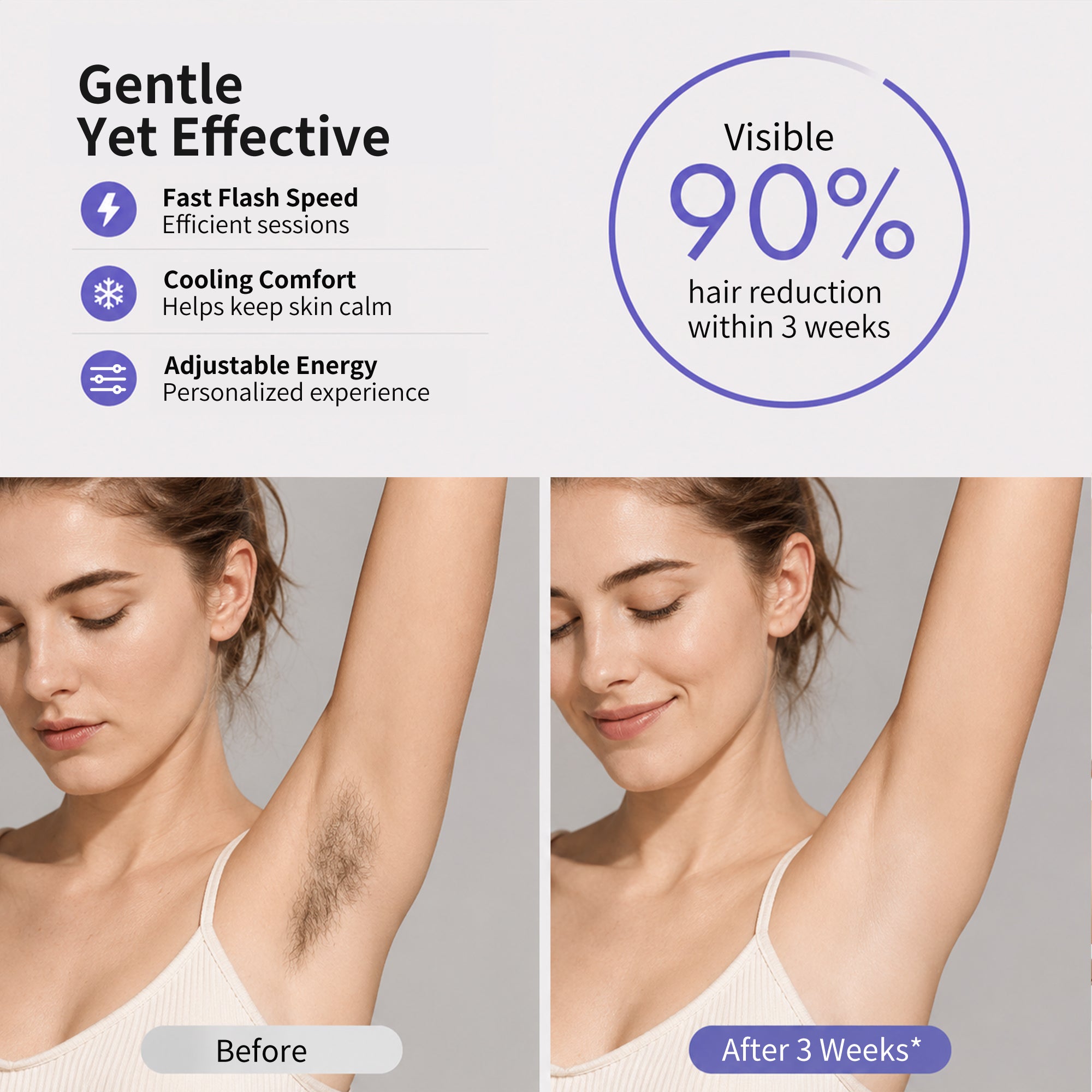 NICEBAY IPL Hair Removal Device with Sapphire Ice Cooling, At-Home Comfort Hair Remover for Women & Men, 4 Levels, Auto Flash, Face & Body